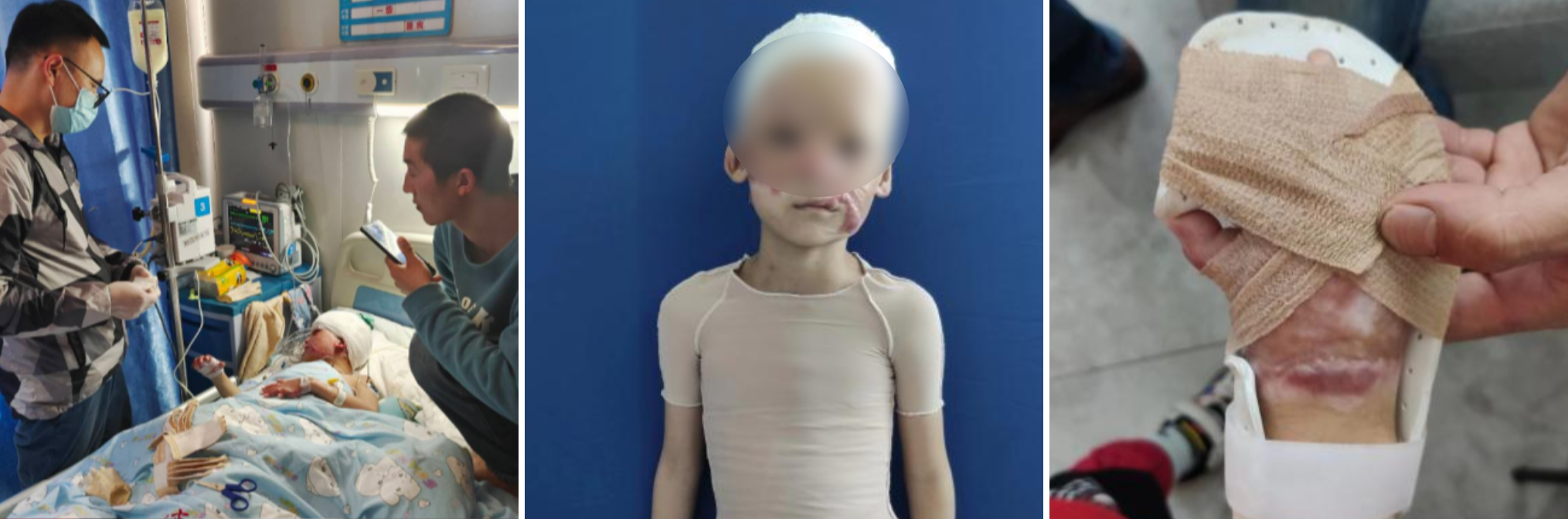 broken image