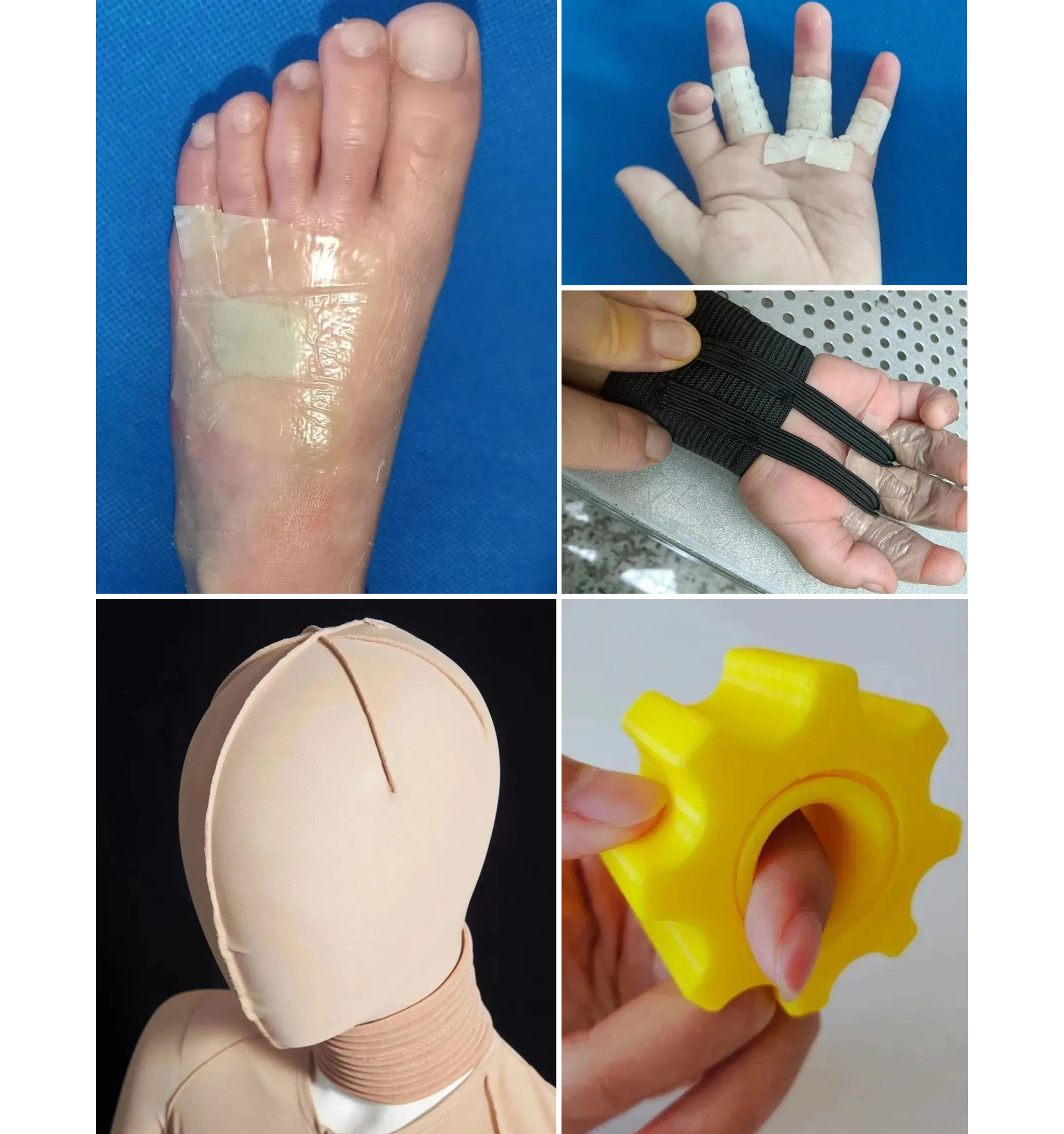 broken image