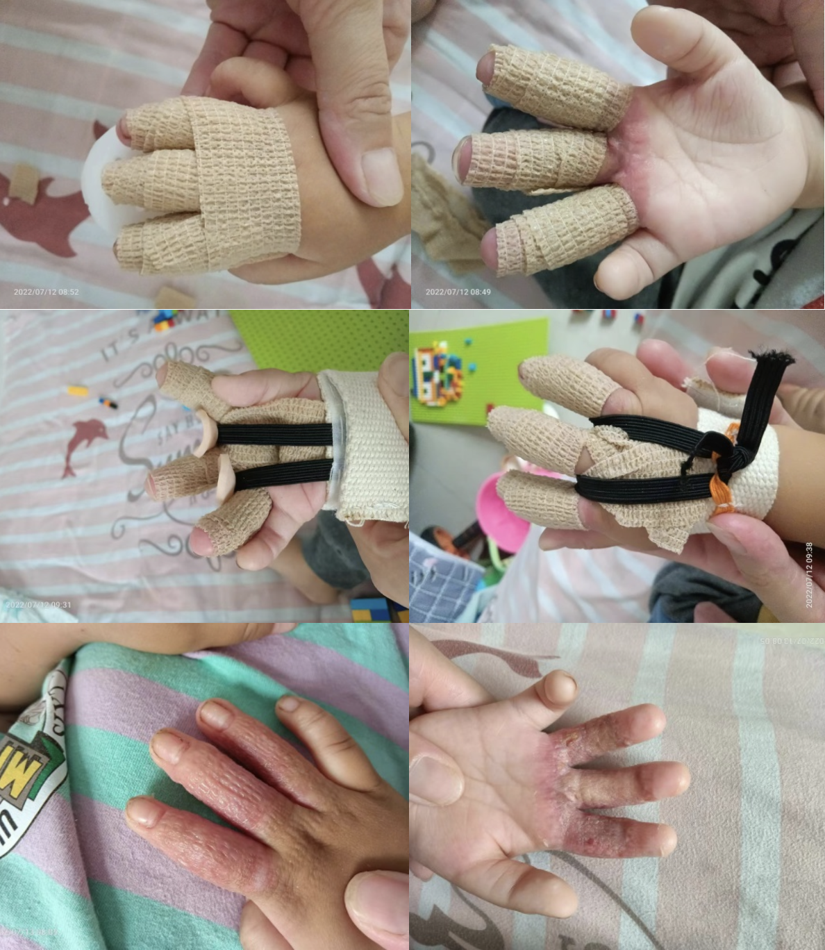 broken image