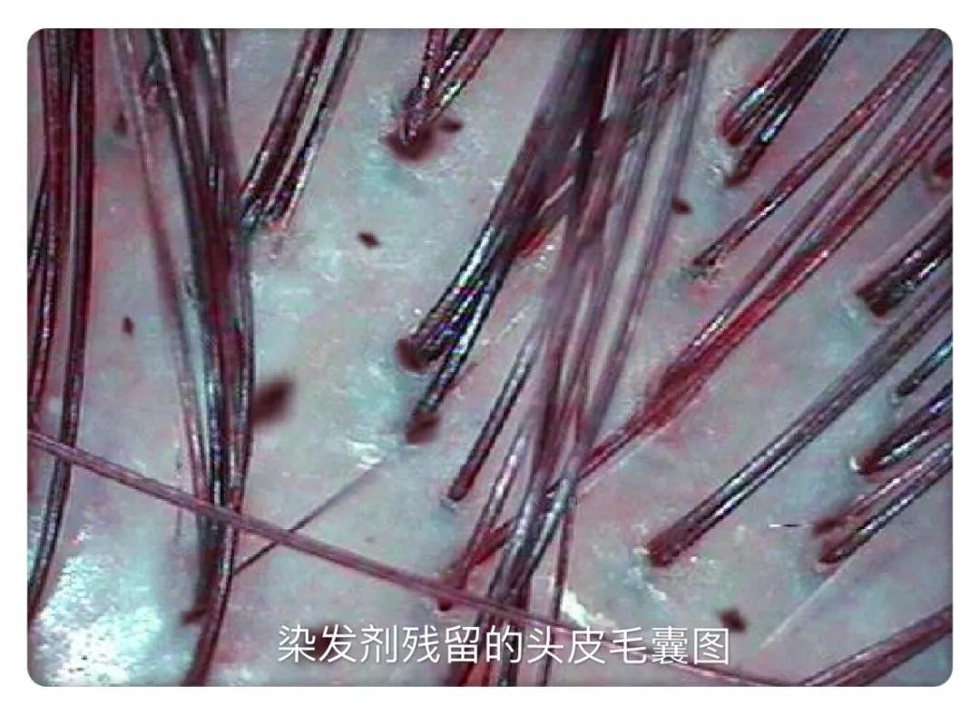 健康头皮,健康头皮图片,正常健康的头皮图片(第2页)_大山谷图库