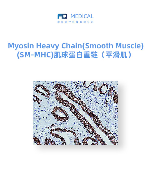 Myosin Heavy Chain (Smooth Muscle) (SM-MHC) 肌球蛋白重链  (平滑肌)