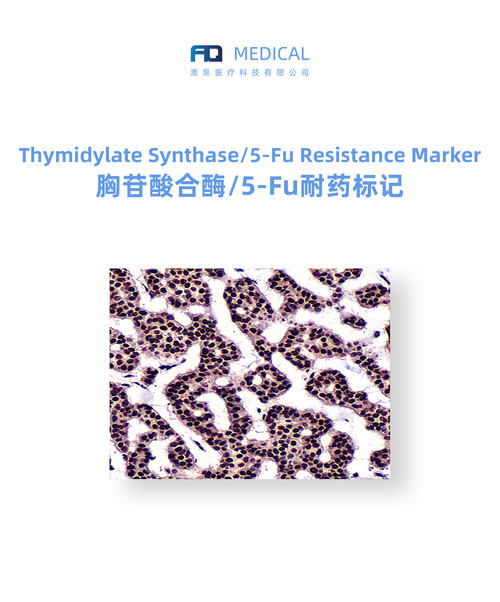 Thymidylate Synthase/5-Fu Resistance Marker 胸苷酸合酶/5-Fu耐药标记