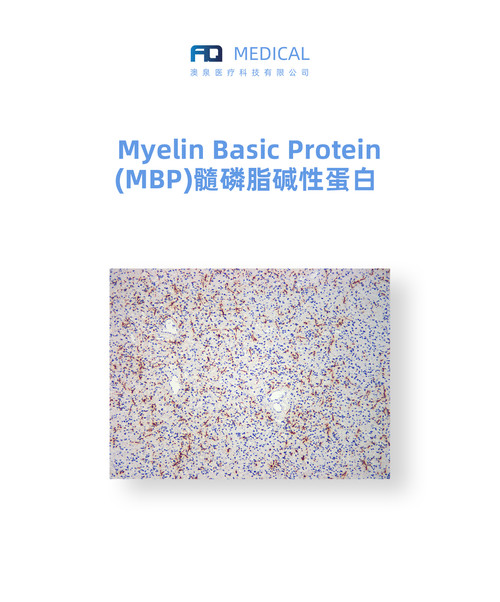 Myelin Basic Protein (MBP) 髓磷脂碱性蛋白