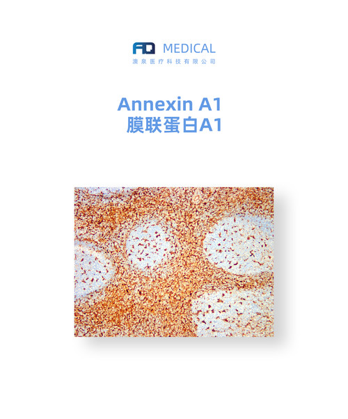 Annexin A1  膜联蛋白A1