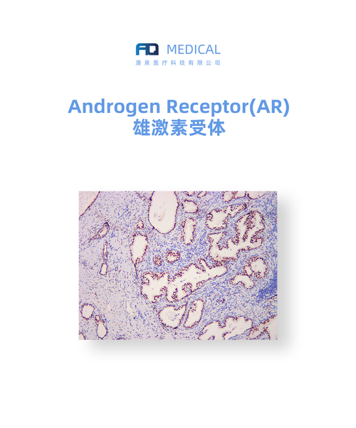 Androgen Receptor (AR)  雄激素受体
