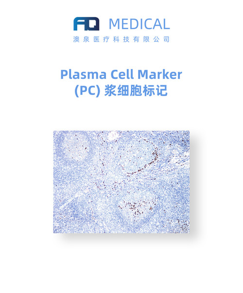Plasma Cell Marker (PC) 浆细胞标记