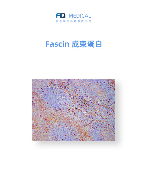Fascin  成束蛋白