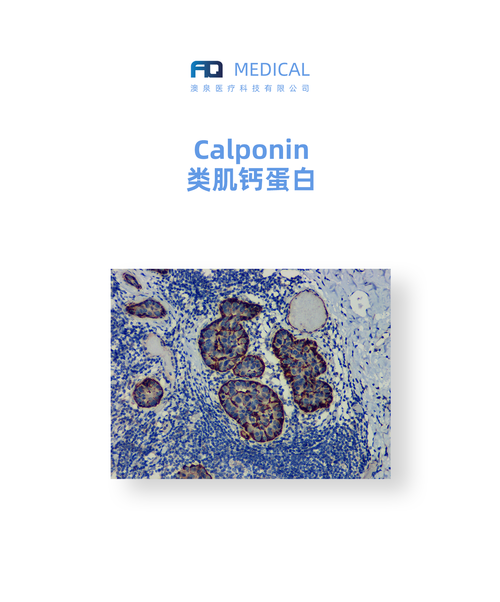 Calponin 类肌钙蛋白