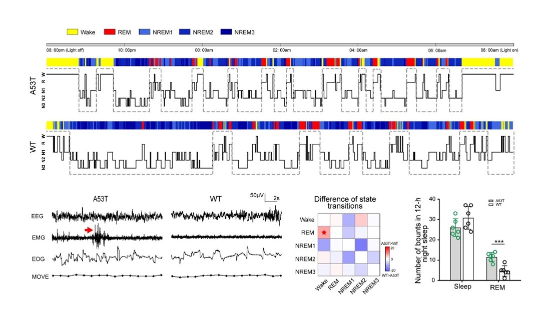 图1 病因性PD猴模型从临床表型到病理表型均高度模拟PD病人